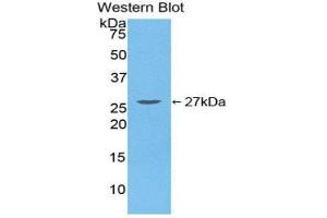 Western Blotting (WB) image for anti-Transforming Growth Factor, beta-Induced, 68kDa (TGFBI) (AA 423-632) antibody (ABIN1860733) (TGFBI Antikörper  (AA 423-632))