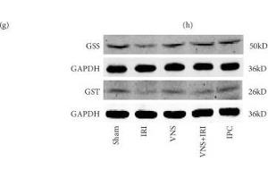 VNS regulated the levels of glutathione and upregulated protein and mRNA levels of glutathione synthetase and glutathione S-transferase. (GST Antikörper)