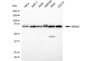 Western blotting analysis using NR0B1 antibody (ABIN7799650).