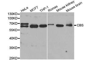 Western blot analysis of extracts of various cell lines, using CBS antibody. (CBS Antikörper  (AA 252-551))