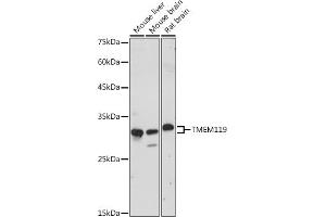 Western blot analysis of extracts of various cell lines, using TMEM119 antibody (ABIN7270953) at 1:1000 dilution. (TMEM119 Antikörper)