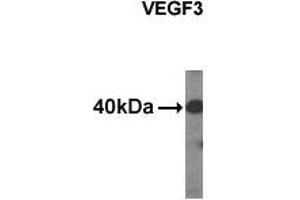 Western Blotting (WB) image for anti-Vascular Endothelial Growth Factor C (VEGFC) (C-Term), (N-Term) antibody (ABIN356356) (VEGFC Antikörper  (C-Term, N-Term))