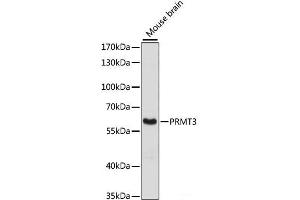 Western blot analysis of extracts of Mouse brain using PRMT3 Polyclonal Antibody at dilution of 1:3000. (PRMT3 Antikörper)
