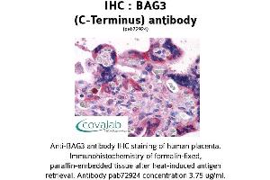 Image no. 3 for anti-BCL2-Associated Athanogene 3 (BAG3) (C-Term) antibody (ABIN1732194) (BAG3 Antikörper  (C-Term))