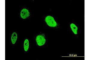 Immunofluorescence of monoclonal antibody to ANKRD17 on HeLa cell. (ANKRD17 Antikörper  (AA 2501-2603))
