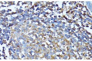 Immunohistochemistry (Paraffin-embedded Sections) (IHC (p)) image for anti-Chemokine (C-X-C Motif) Receptor 1 (CXCR1) antibody (ABIN7259098)