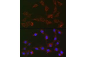 Immunofluorescence analysis of NIH/3T3 cells using [KO Validated] SQSTM1/p62 Rabbit mAb (ABIN7270205) at dilution of 1:50 (40x lens). (SQSTM1 Antikörper)