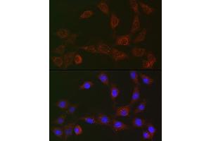 Immunofluorescence analysis of NIH/3T3 cells using [KO Validated] SQSTM1/p62 Rabbit mAb (ABIN7270205) at dilution of 1:50 (40x lens).