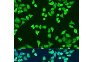 Immunofluorescence analysis of U2OS cells using SMN2 Polyclonal Antibody at dilution of 1:100. (SMN2 Antikörper)