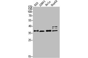 Western blot analysis of 823 22RV1 HELA HEPG2 Cell Lysate, antibody was diluted at 1:2000. (PMEPA1 Antikörper  (AA 1268-1341))