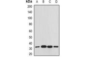 Western blot analysis of RACK1 expression in Raji (A), Hela (B), mouse spleen (C), mouse liver (D) whole cell lysates. (GNB2L1 Antikörper)