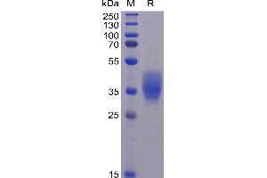 SDS-PAGE (SDS) image for CD200 (CD200) (AA 31-232) protein (His tag) (ABIN6961153)