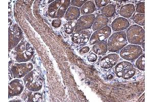 IHC-P Image RPSA antibody [N1C3] detects RPSA protein at cytoplasm on mouse small intestine by immunohistochemical analysis. (RPSA/Laminin Receptor Antikörper)