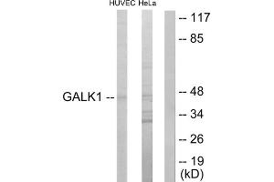 Western blot analysis of extracts from HUVEC cells and HeLa cells, using GALK1 antibody. (GALK1 Antikörper  (N-Term))
