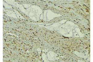 ABIN6277334 at 1/100 staining Mouse muscle tissue by IHC-P. (FBXO32 Antikörper  (N-Term))