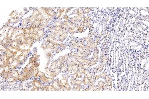 Detection of FXR in Rat Kidney Tissue using Polyclonal Antibody to Farnesoid X Receptor (FXR) (NR1H4 Antikörper  (AA 375-568))
