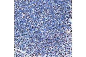 Immunohistochemistry (IHC) image for anti-SET Nuclear Oncogene (SET) antibody (ABIN7270265)