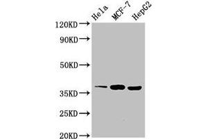 Western Blot Positive WB detected in: Hela whole cell lysate, MCF-7 whole cell lysate, HepG2 whole cell lysate All lanes: ALX1 antibody at 3 μg/mL Secondary Goat polyclonal to rabbit IgG at 1/50000 dilution Predicted band size: 37 kDa Observed band size: 37 kDa (ALX1 Antikörper  (AA 10-304))