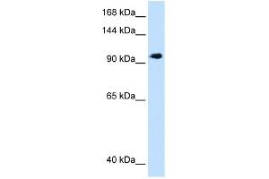 WB Suggested Anti-SEC63 Antibody Titration:  1. (SEC63 Antikörper  (C-Term))