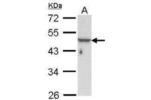 WB Image Sample (30 ug of whole cell lysate) A: Hela 10% SDS PAGE antibody diluted at 1:1000 (Keratin 33B Antikörper)