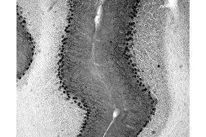 Adult rat cerebellar immunohistochemistry.
