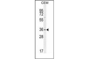Western blot analysis of Musashi-1 Antibody (N-term) in CEM cell line lysates (35ug/lane). (MSI1 Antikörper  (N-Term))