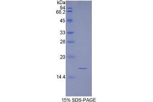 SDS-PAGE of Protein Standard from the Kit (Highly purified E. (Inhibin alpha ELISA Kit)