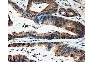 Immunohistochemistry (IHC) image for anti-Fumarylacetoacetate Hydrolase Domain Containing 2A (FAHD2A) antibody (ABIN1498184) (FAHD2A Antikörper)