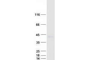 Western Blotting (WB) image for Centromere Protein L (CENPL) (Transcript Variant 2) protein (Myc-DYKDDDDK Tag) (ABIN2713908)