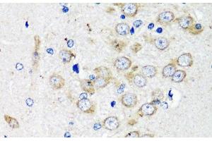 Immunohistochemistry of paraffin-embedded Rat brain using TSC2 Polyclonal Antibody at dilution of 1:200 (40x lens). (Tuberin Antikörper)