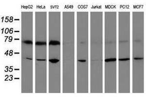 Image no. 2 for anti-Crystallin, Zeta, Homolog antibody (ABIN1497655) (CRYZL1 Antikörper)