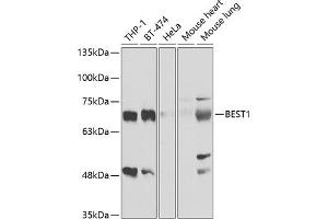 Western blot analysis of extracts of various cell lines, using BEST1 antibody (ABIN6127516, ABIN6137535, ABIN6137537 and ABIN6221403) at 1:1000 dilution. (Bestrophin 1 Antikörper  (AA 376-585))