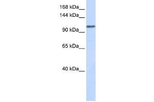 WDR63 antibody used at 1 ug/ml to detect target protein. (WDR63 Antikörper  (Middle Region))