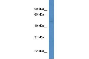 WB Suggested Anti-Kcnk5 Antibody   Titration: 1. (KCNK5 Antikörper  (Middle Region))