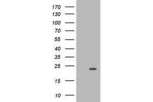 Western Blotting (WB) image for anti-Muscle RAS Oncogene Homolog (MRAS) antibody (ABIN1499553)