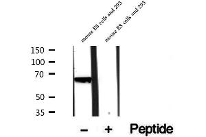 Western blot analysis of extracts of rat brain tissue, using PHF19 antibody. (PHF19 Antikörper  (Internal Region))