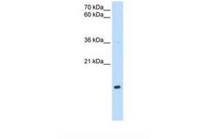 Image no. 1 for anti-NADH Dehydrogenase (Ubiquinone) 1 beta Subcomplex, 5, 16kDa (NDUFB5) (AA 69-118) antibody (ABIN6738155) (NDUFB5 Antikörper  (AA 69-118))
