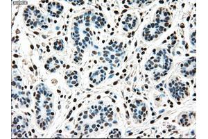 Immunohistochemical staining of paraffin-embedded breast tissue using anti-MAP2K4 mouse monoclonal antibody. (MAP2K4 Antikörper)