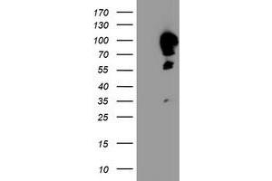 HEK293T cells were transfected with the pCMV6-ENTRY control (Left lane) or pCMV6-ENTRY CAST (Right lane) cDNA for 48 hrs and lysed. (Calpastatin Antikörper)