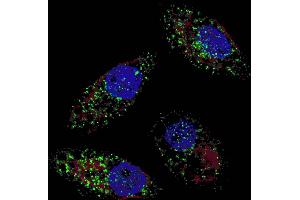 Immunofluorescence (IF) image for anti-Microtubule-Associated Protein 1 Light Chain 3 beta (MAP1LC3B) (AA 89-122), (cleaved) antibody (ABIN388484)