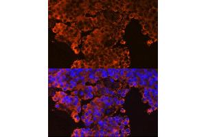 Immunofluorescence analysis of rat pituitary gland cells using GHRHR Rabbit pAb (ABIN6127953, ABIN6141077, ABIN6141078 and ABIN6224478) at dilution of 1:100 (40x lens). (GHRHR Antikörper  (AA 1-130))