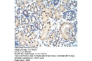 Immunohistochemistry (IHC) image for anti-Acidic (Leucine-Rich) Nuclear phosphoprotein 32 Family, Member A (ANP32A) (Middle Region) antibody (ABIN2778667)