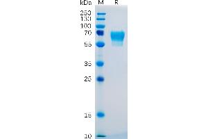 SDS-PAGE (SDS) image for CD27 Molecule (CD27) (AA 20-191) protein (Fc Tag) (ABIN6961160)