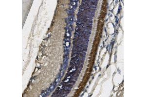 IHC analysis of PDE6 beta/PDE6B using anti-PDE6 beta/PDE6B antibody (ABIN7600893).