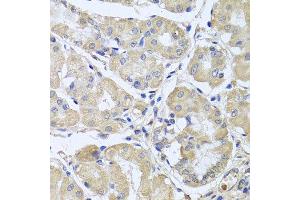 Immunohistochemistry of paraffin-embedded human gastric using CEP57L1 antibody at dilution of 1:100 (x40 lens). (CEP57L1 Antikörper)