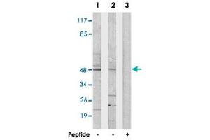 Western blot analysis of extracts from 293 cells (Lane 1) and HUVEC cells (Lane 2 and lane 3), using CSTF1 polyclonal antibody . (CSTF1 Antikörper  (N-Term))