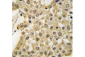 Immunohistochemistry (IHC) image for anti-Mdm2, p53 E3 Ubiquitin Protein Ligase Homolog (Mouse) (MDM2) (AA 141-176) antibody (ABIN3031734)