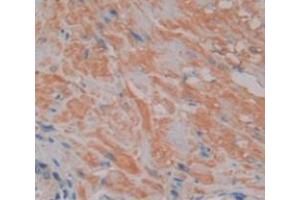 IHC-P analysis of Human Tissue, with DAB staining. (NFAT1 Antikörper  (AA 392-574))