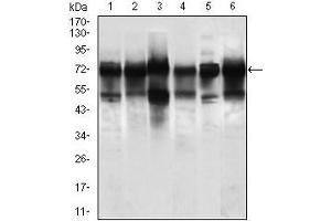Western blot analysis using WHSC2 mouse mAb against Jurkat (1), HeLa (2), HEK293 (3), A549 (5), SPC-A-1 (6) cell lysate, and Rat brain (4) tissue lysate. (WHSC2 Antikörper  (AA 280-511))
