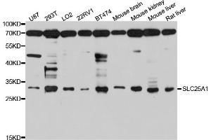 Western blot analysis of extracts of various cell lines, using SLC25A1 antibody. (Slc25a1 Antikörper)